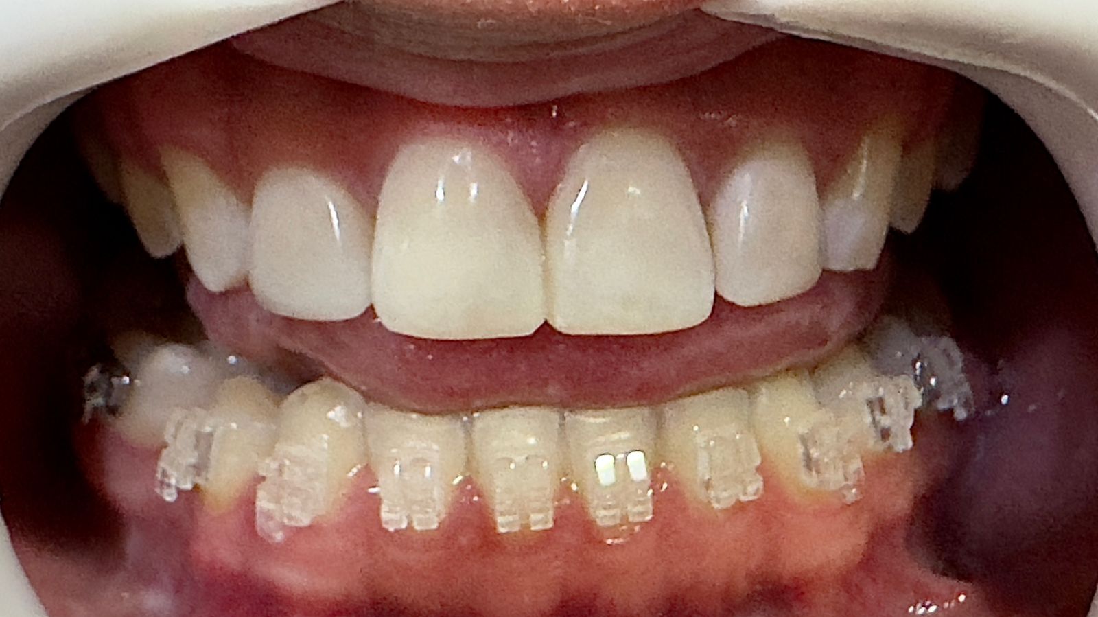 WhatsApp Image 2025-04-07 at 15.28.57 (1)