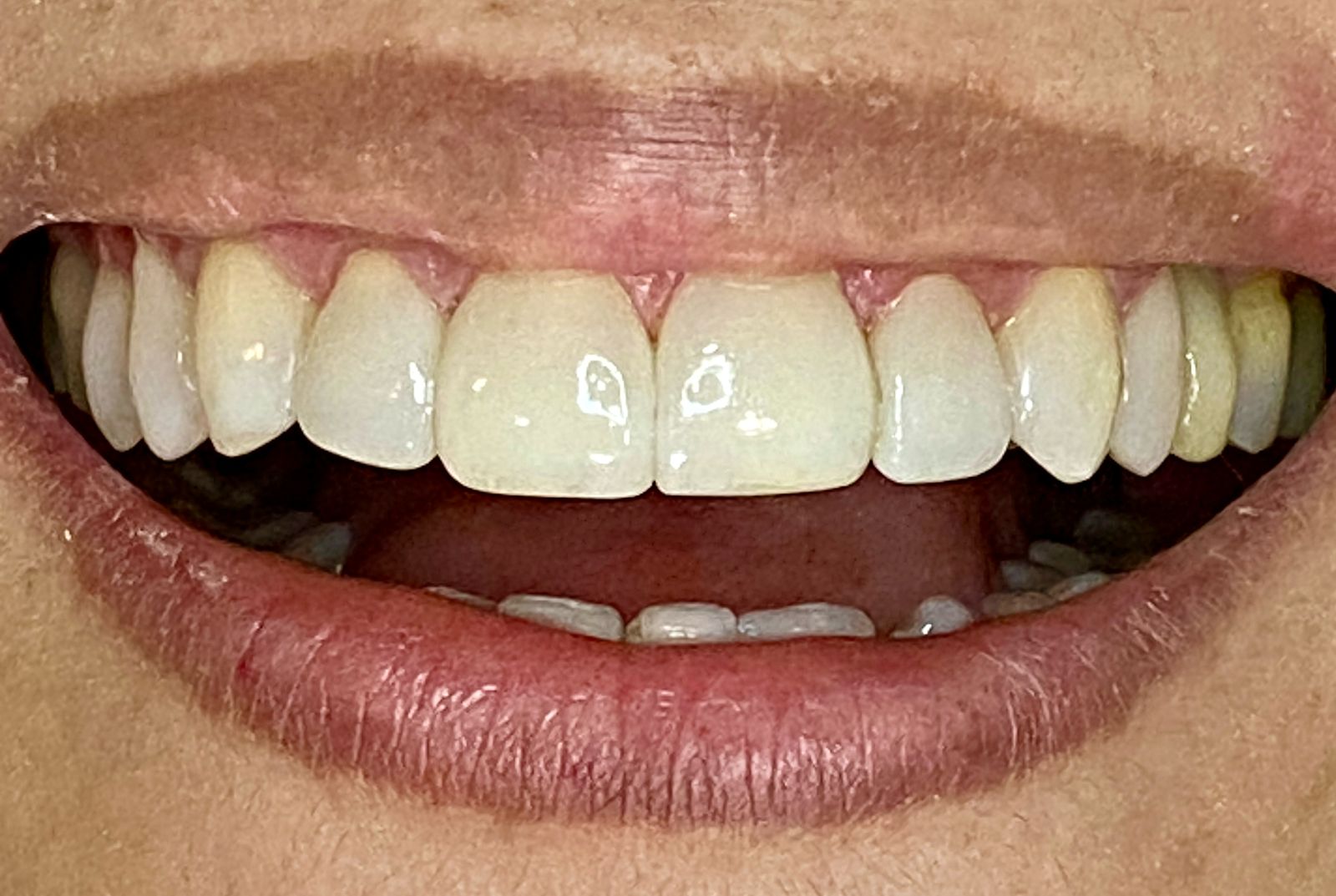 WhatsApp Image 2025-04-07 at 15.28.58 (2)