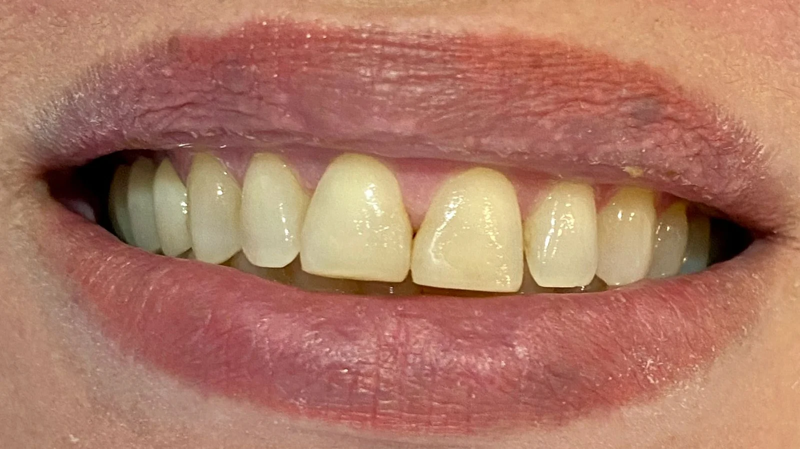 Sorriso renovado 4